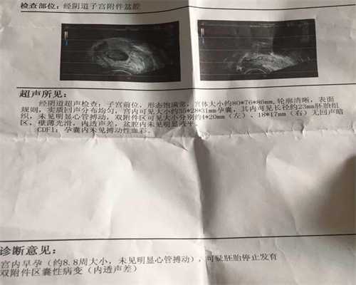 北京不孕不育试管代孕医院_北京哪里有做代孕的_初次怀孕做药流还是无痛人流
