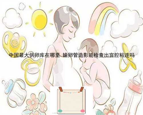 中国最大供卵库在哪里 输卵管造影能检查出宫腔粘连吗