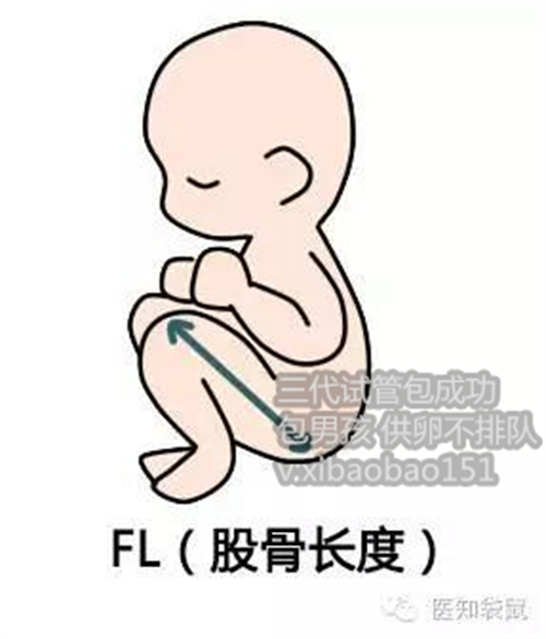 北京助孕公司生男孩,孕期远离痔疮的4个妙招